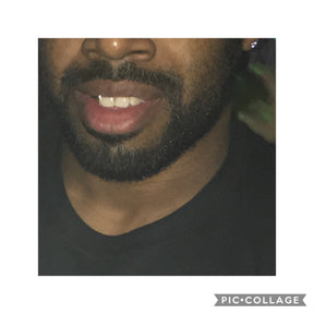 Ayurvedic Beard Oil Elixir